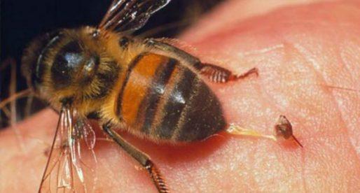 Лечение укусом пчелы, аллергия на укусы пчел