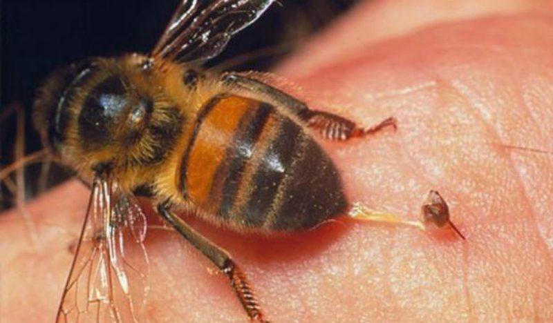Лечение укусом пчелы, аллергия на укусы пчел